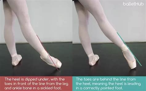 What Is a Sickled Foot in Dance: A Multifaceted Analysis